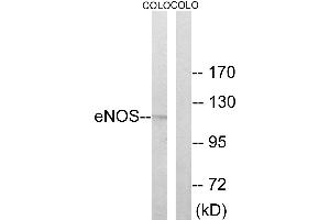 Western blot analysis of extracts from COLO cells, using Enos (Ab-494) antibody. (ENOS anticorps  (Thr494))