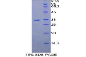 SDS-PAGE analysis of Mouse Ribonuclease Inhibitor Protein.
