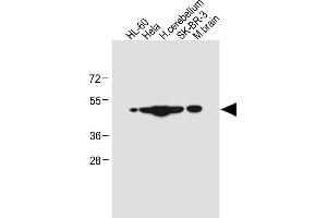 All lanes : Anti-CEPT1 Antibody (N-term) at 1:4000 dilution Lane 1: HL-60 whole cell lysate Lane 2: Hela whole cell lysate Lane 3: Human cerebellum tissue lysate Lane 4: SK-BR-3 whole cell lysate Lane 5: Mouse brain tissue lysate Lysates/proteins at 20 μg per lane.