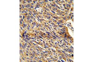Immunohistochemistry (IHC) image for anti-Enoyl-CoA Delta Isomerase 1 (ECI1) antibody (ABIN3003901)