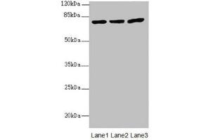Western blot All lanes: KBTBD7 antibody at 1. (KBTBD7 anticorps  (AA 475-684))