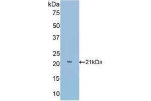 Detection of Recombinant Slit1, Mouse using Polyclonal Antibody to Slit Homolog 1 (Slit1)