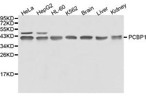 Western blot analysis of extracts of various cell lines, using PCBP1 antibody. (PCBP1 anticorps)