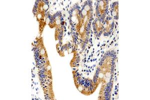 Immunohistochemical analysis of paraffin-embedded H. (ADRA1D anticorps  (N-Term))