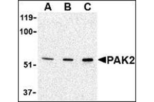 Western blot analysis of PAK2 in Jurkat lysate with this product at (A) 0.