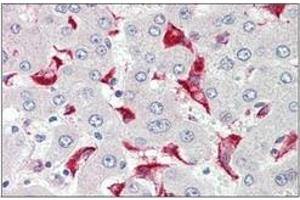 Human Liver: Formalin-Fixed, Paraffin-Embedded (FFPE)