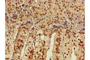 Immunohistochemistry of paraffin-embedded human adrenal gland tissue using ABIN7175600 at dilution of 1:100