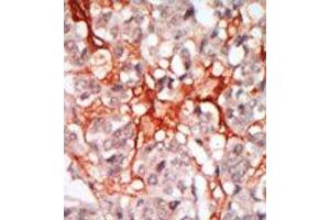 Image no. 1 for anti-Megakaryocyte-Associated tyrosine Kinase (MATK) (N-Term) antibody (ABIN359988)