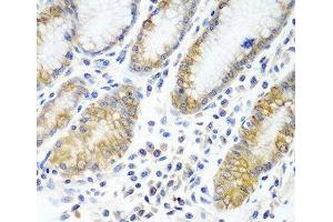 Immunohistochemistry of paraffin-embedded Human stomach using ATAD3A Polyclonal Antibody at dilution of 1:100 (40x lens). (ATAD3A anticorps)