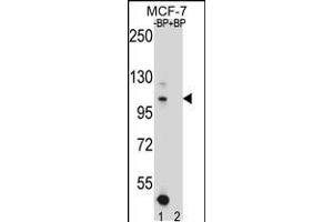 Western blot analysis of HIPK1 Antibody Pab pre-incubated without(lane 1) and with(lane 2) blocking peptide in MCF-7 cell line lysate.