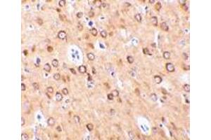 Immunohistochemistry of CTRP4 in rat brain with CTRP4 antibody at 10 μg/ml. (C1QTNF4 anticorps  (C-Term))
