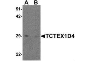 Western blot analysis of TCTEX1D4 in mouse liver tissue lysate with TCTEX1D4 antibody at 1 ug/mL in (A) the absence and (B) the presence of blocking peptide. (TCTEX1D4 anticorps  (N-Term))