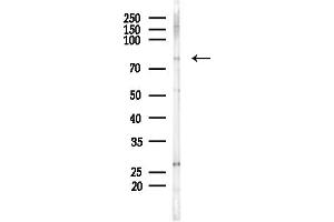 anti-Centrosomal Protein 78kDa (CEP78) (Internal Region) antibody
