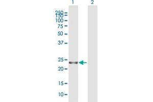 Western Blot analysis of RTN3 expression in transfected 293T cell line by RTN3 MaxPab polyclonal antibody. (Reticulon 3 anticorps  (AA 1-236))