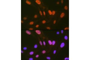 anti-Homeodomain Interacting Protein Kinase 2 (HIPK2) antibody