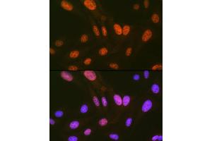 Immunofluorescence analysis of U-2 OS cells using HIPK2 Rabbit mAb (ABIN7267779) at dilution of 1:100 (40x lens). (HIPK2 anticorps)