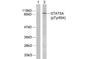Western blot analysis of extracts from HeLa cells using STAT5A (phospho-Tyr694) antibody (E011048). (STAT5A anticorps  (pTyr694))