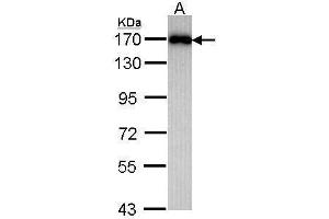 WB Image Sample (30 ug of whole cell lysate) A: Raji 7. (MAGI2 anticorps  (C-Term))