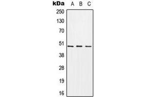 Western blot analysis of CHST1 expression in A549 (A), Raw264. (CHST1 anticorps  (Center))
