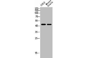 Western Blot analysis of MOUSE-BRAIN COLO cells using NK-1R Polyclonal Antibody (TACR1 anticorps  (Internal Region))