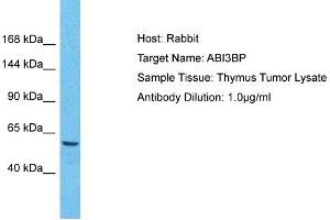 Host: Rabbit Target Name: ABI3BP Sample Tissue: Human Thymus Tumor Antibody Dilution: 1ug/ml (ABI3BP anticorps  (C-Term))