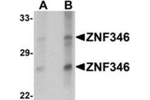 Western blot analysis of ZNF346 in human kidney tissue lysate with ZNF346 antibody at (A) 1 and (B) 2 μg/ml. (ZNF346 anticorps  (C-Term))