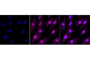 Immunocytochemical staining of H9C2 cells with Ring-box 1 antibody (ABIN7800254), 1:1,000).