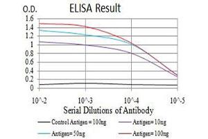 Black line: Control Antigen (100 ng),Purple line: Antigen (10 ng), Blue line: Antigen (50 ng), Red line:Antigen (100 ng)