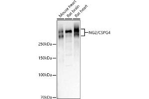 Western blot analysis of extracts of various cell lines, using NG2/CSPG4 antibody (ABIN1679389, ABIN3017852, ABIN3017853 and ABIN5664347) at 1:1000 dilution. (NG2 anticorps  (AA 1950-2210))