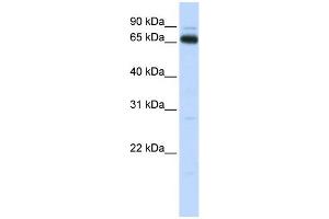 WB Suggested Anti-KBTBD5 Antibody Titration:  0. (KBTBD5 anticorps  (C-Term))