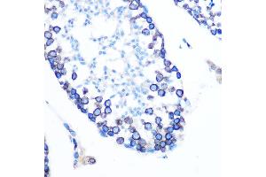 Immunohistochemistry of paraffin-embedded mouse testis using Lamin B1 Rabbit mAb (ABIN7268180) at dilution of 1:100 (40x lens). (Lamin B1 anticorps)