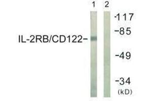 Western blot analysis of extracts from COS7 cells, using IL-2Rβ/CD122 (Ab-364) antibody. (IL2 Receptor beta anticorps  (Tyr364))