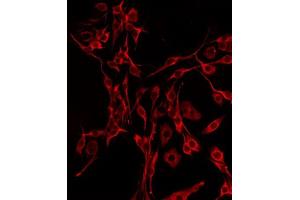 ABIN6277319 staining Hela by IF/ICC. (DBH anticorps  (Internal Region))