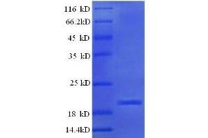 Protein expressed in E.