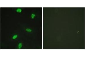 Immunofluorescence analysis of HeLa cells, using Retinoblastoma (Phospho-Thr821) Antibody. (Retinoblastoma Protein (Rb) anticorps  (pThr821))