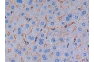 Detection of ALB in Mouse Liver Tissue using Polyclonal Antibody to Albumin (ALB) (Albumin anticorps)