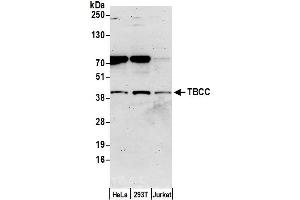 Western Blotting (WB) image for anti-Tubulin Folding Cofactor C (TBCC) (AA 1-50) antibody (ABIN7449259)