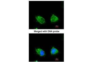 ICC/IF Image Immunofluorescence analysis of paraformaldehyde-fixed HeLa, using INPP1, antibody at 1:200 dilution.