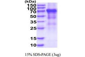 SDS-PAGE (SDS) image for Killer Cell Immunoglobulin-Like Receptor, three Domains, Long Cytoplasmic Tail, 2 (KIR3DL2) (AA 22-340) protein (hIgG-His-tag) (ABIN6388088) (KIR3DL2 Protein (AA 22-340) (hIgG-His-tag))
