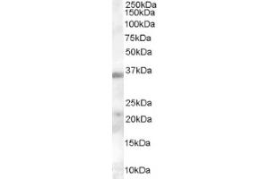 Image no. 1 for anti-Hepatitis A Virus Cellular Receptor 2 (TIM 3) (Internal Region) antibody (ABIN374646) (TIM3 anticorps  (Internal Region))