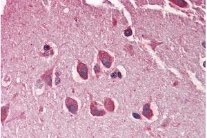 ABIN570801 (5µg/ml) staining of paraffin embedded Human Cortex. (Adlican anticorps  (Internal Region))