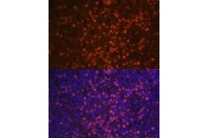 Immunofluorescence analysis of human spleen using CR2/CD21 Polyclonal Antibody (ABIN6132246, ABIN6138992, ABIN6138993 and ABIN6224458) at dilution of 1:100 (40x lens).