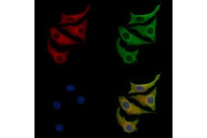 anti-Mannose-6-Phosphate Receptor (Cation Dependent) (M6PR) antibody