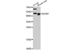 Western blot analysis of extracts of various cell lines, using KLRB1 antibody. (CD161 anticorps)