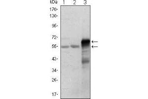 Western blot analysis using ETS1 mouse mAb against Jurkat (1), HepG2 (2) and ETS1-hIgGFc transfected HEK293 (3) cell lysate. (ETS1 anticorps)