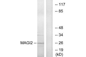 Western blot analysis of extracts from HT-29 cells, using MAGI2 antibody. (MAGI2 anticorps  (Internal Region))