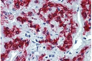 Human Adrenal: Formalin-Fixed, Paraffin-Embedded (FFPE)