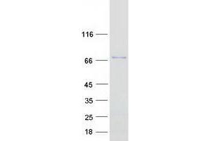 Validation with Western Blot