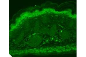 TrpV3 Immunofluorescence Immunohistochemistry of mouse anti-TrpV3 antibody.