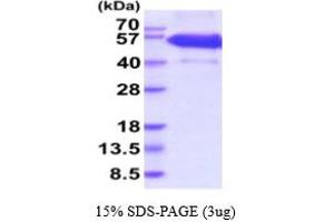 SDS-PAGE (SDS) image for Ectodysplasin A2 Receptor (EDA2R) (AA 1-138) protein (hIgG-His-tag) (ABIN5854822)